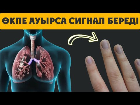 Бейне: Неліктен сызбалар ауырады?