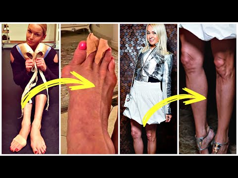 Российские звёзды с самыми некрасивыми ногами