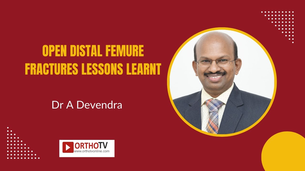 Dr A Devendra - Open Distal Femure Fractures lessons learnt - YouTube