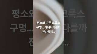 누군가 피해자의 슬리퍼에 몰카+전파 공격장치를 달았습니다