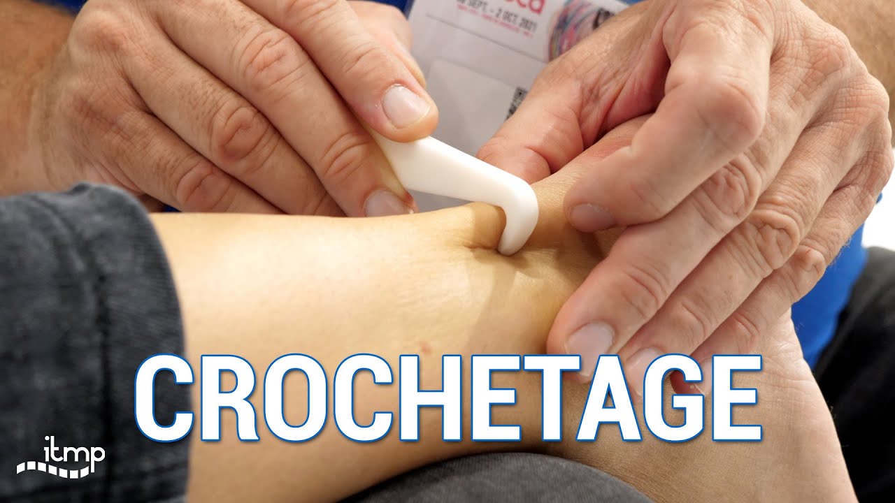 Technique de Crochetage - RÉÉDUCA21