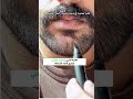 قلم لحية لتغطية الفراغات قلم لحية لتغطية الفراغات