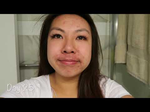 Video Curology Day 14-31!! |Part 2 - youtube