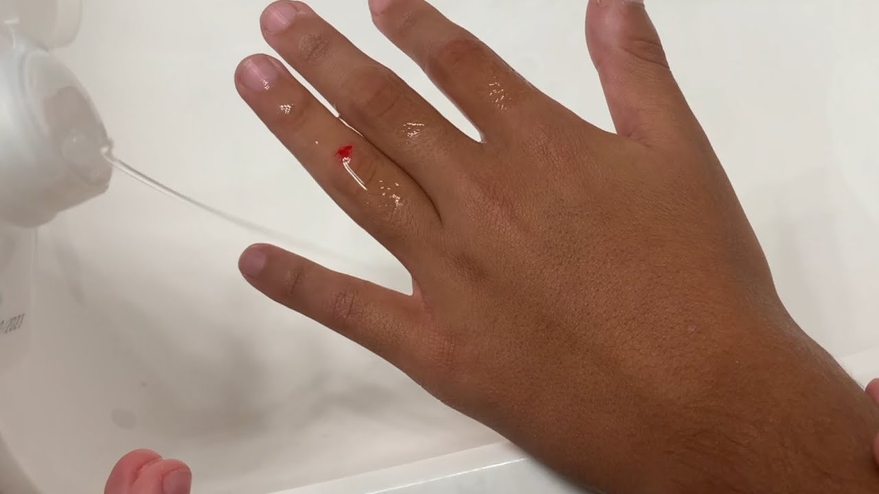 Putting rubbing alcohol on cut *very painful* YouTube