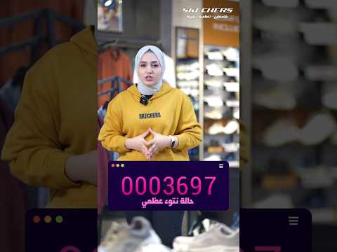 سكيتشرز حل مشكلة النتوء العظمي اكسبلور  جديد  سكيتشرز