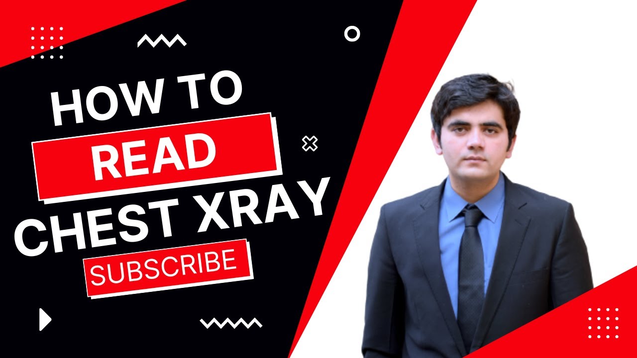 Learn basics of chest x ray in urdu/hindi YouTube