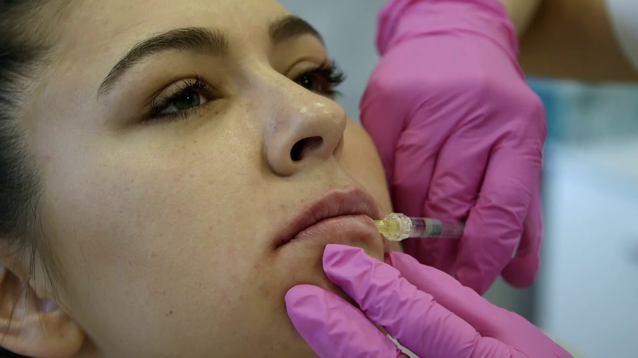 Powiększanie i modelowanie ust.