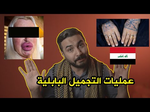 عمليات التجميل في العراق القديم | الموسم الرابع حلقة 29 |