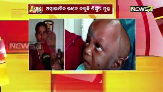 Size Of Head Of Child Growing Rapidly, Husband Dumps Wife screenshot 5