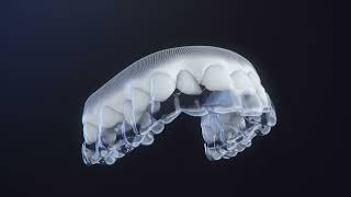 Invisalign Introduction Video for New Patients