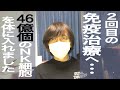 【末期がんと戦う】２回目の免疫治療の結果は・・・【大腸がん】【肝臓がん】【ステージⅣ】