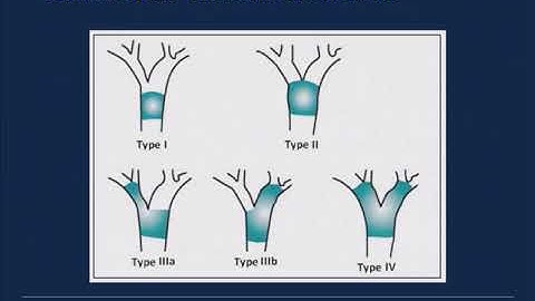 2018 Cholangiocarcinoma Foundation Annual Conference #8 - Day 1 - Management of Biliary Obstruction