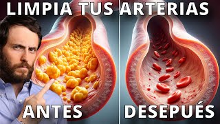 Haz Esto para Destapar tus Arterias y Corregir tu Colesterol by DR LA ROSA 802,048 views 3 months ago 16 minutes