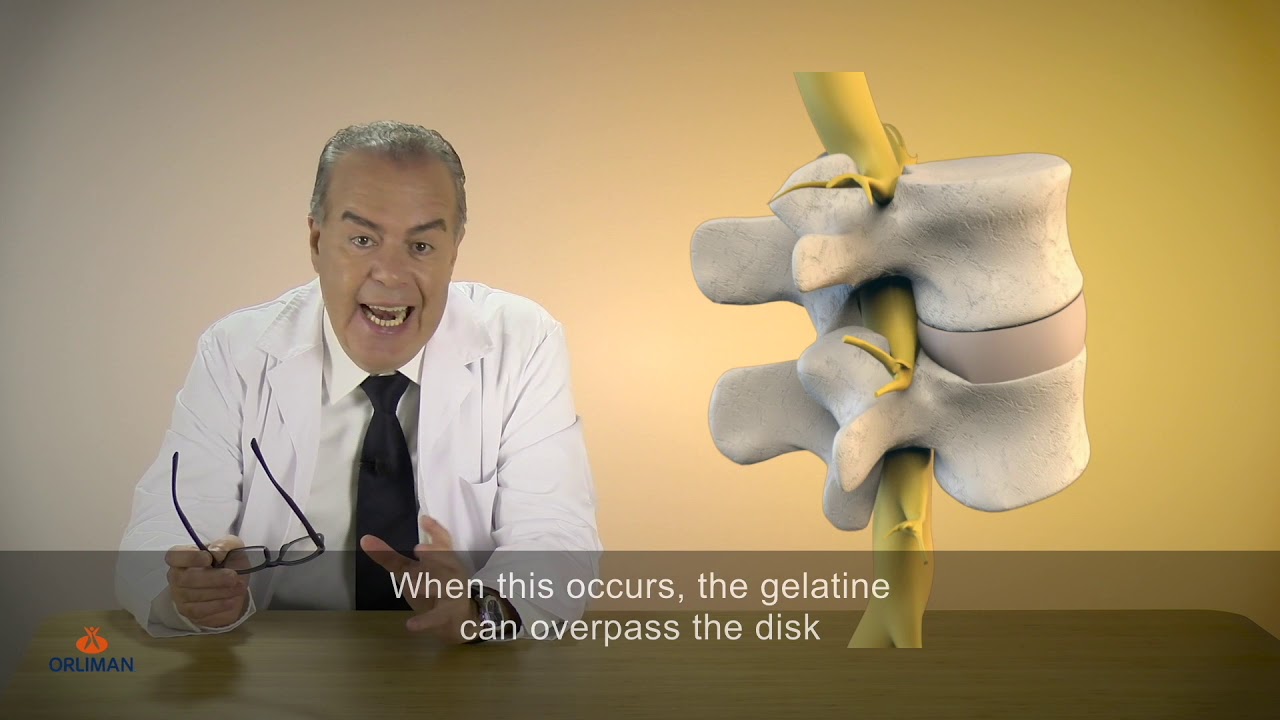 Herniated disk STAR BRACE® DYNAMIC FIX YouTube