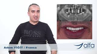 Fransadan diş eksikliği tedavisi için kliniğimize gelen hastamız Adem Yiğit bey