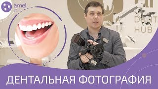 Дентальная фотография. Настройки и фишки для фотографирования зубов