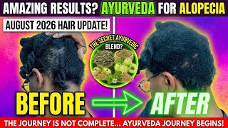 Using Ayurvedic Remedies for Alopecia — My August 2026 Hair Journey