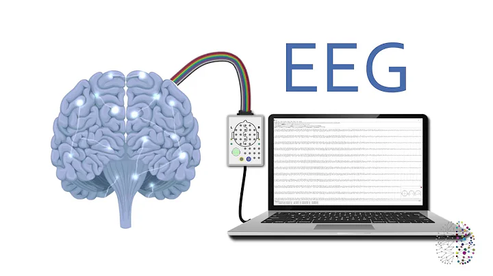QEEG Brain Scans Explained