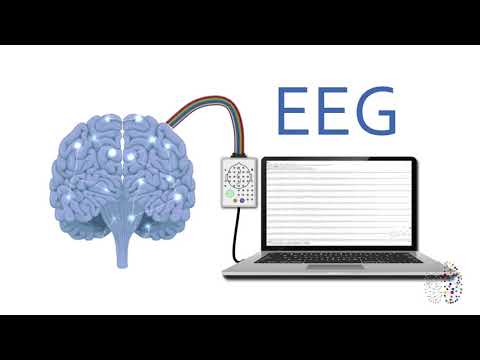 QEEG Brain Scans Explained