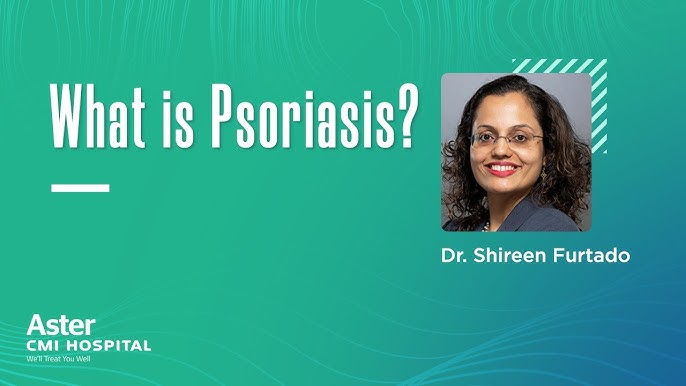 best psoriasis treatment in bangalore