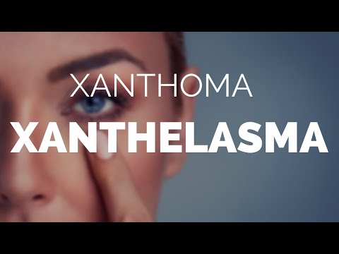 Xanthoma Xanthelasma. whats the difference? 