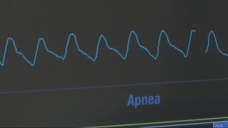 Break Through In Heart Technology