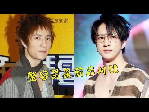 11位整容男星前后对比，薛之谦打针似面瘫，最后一位堪比换脸