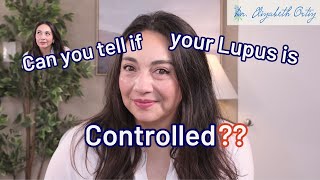How do you know if your lupus is controlled? 5 signs it's not as controlled as you think