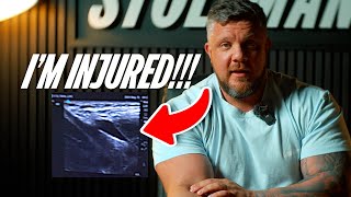 Europe's Strongest Man is INJURED!