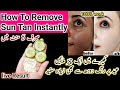 Parmenat Sun Tan Removal within 5 Minute |SunbTan Removal Home Remedy | Pigmentation removal at Home