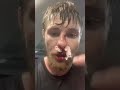 Bryce Mitchell’s Nose vs Dana White’s Healthcare Plan 😂 (MMA Reality Check)