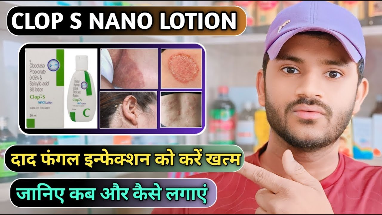 Clop s nano lotion uses in hindi/ how to use clop s nano lotion YouTube