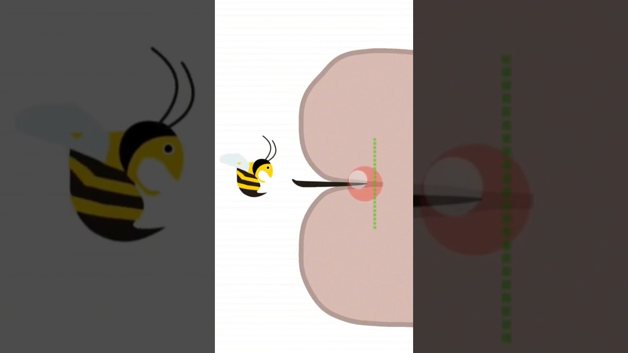 Abelha Picando a Bund@, Arrancando Dente, Vomitando Rato em Help Me Trick Story # 