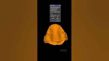 Exocad tip Obtain scanned denture model #exocad #3ddentists #3ddentistry