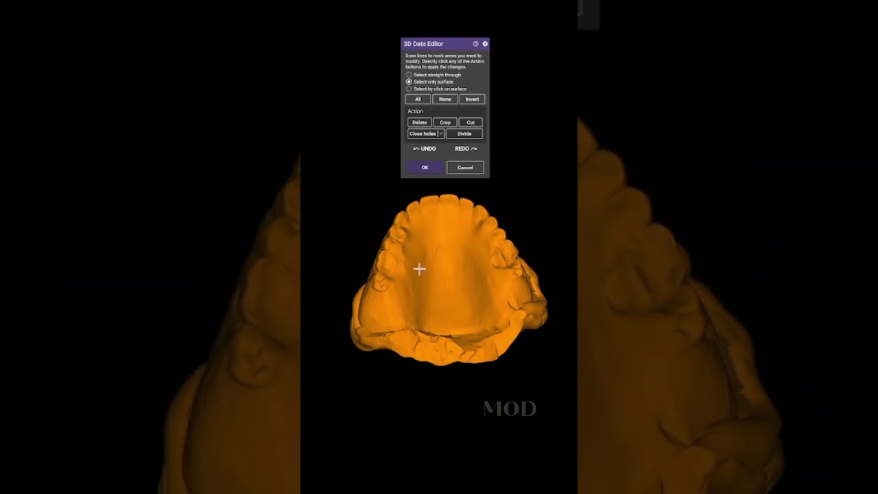 Exocad tip Obtain scanned denture model 