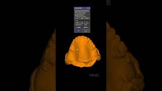 Exocad tip Obtain scanned denture model #exocad #3ddentists #3ddentistry