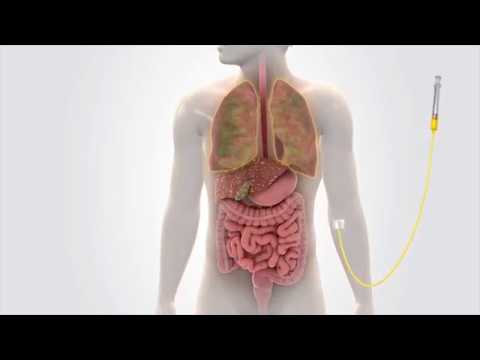 Innovation in Microbiome Research to Prevent C. diff, Antimicrobial Resistance and Improve GI Health