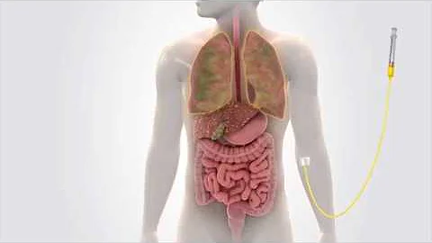 Innovation in Microbiome Research to Prevent C. diff, Antimicrobial Resistance and Improve GI Health