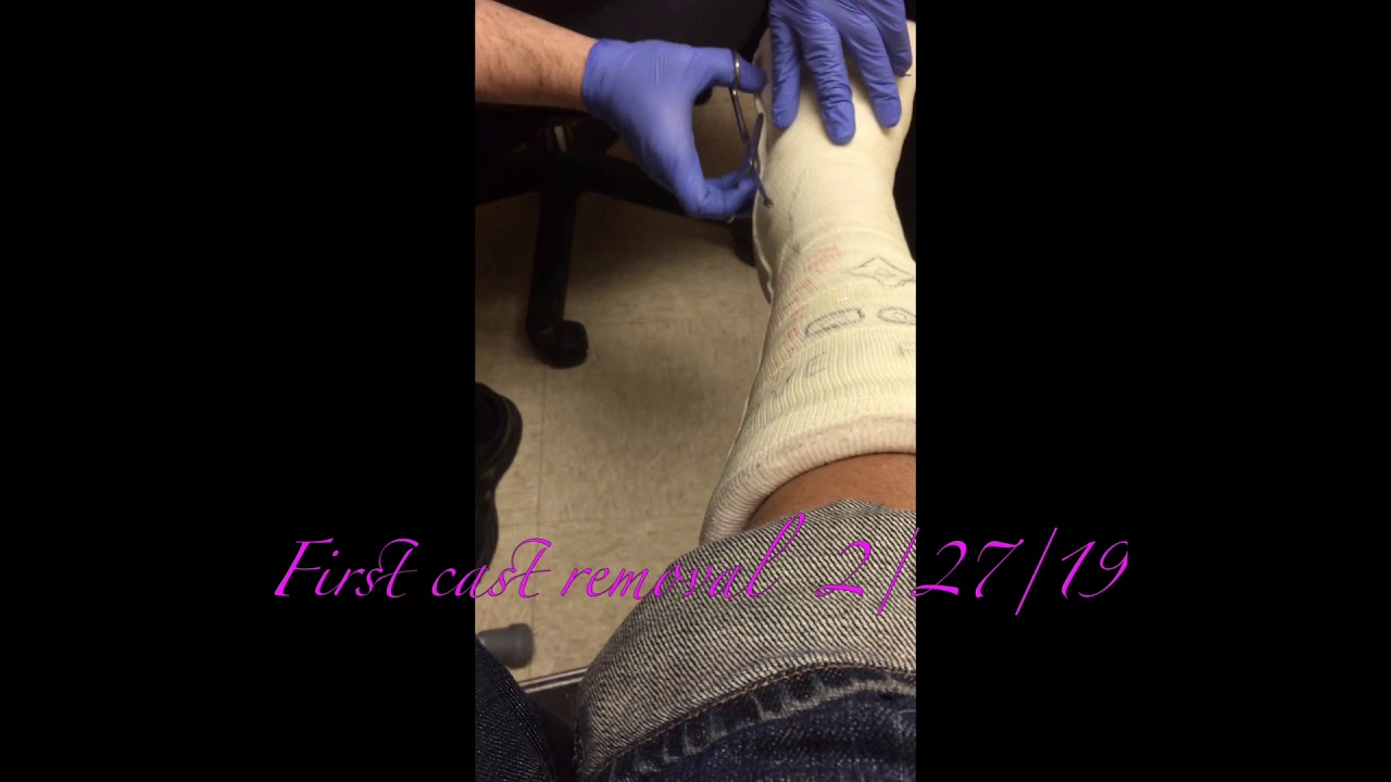 Cast removal 22719 YouTube