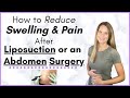 Liposuction Recovery - Ways to Reduce Swelling and Pain after Abdomen Surgery