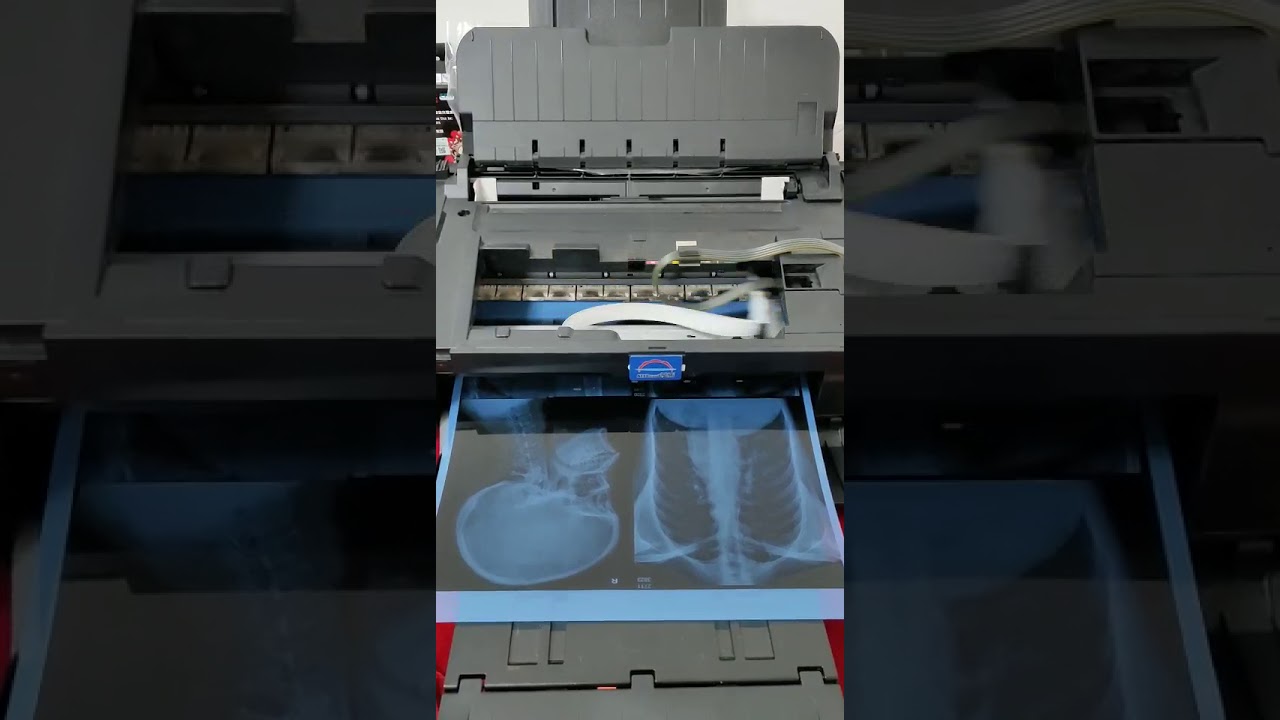 new technology medical film