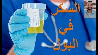 أسهل شرح وتعليم تحليل السكر في البول glucose examination in complete urine analysis