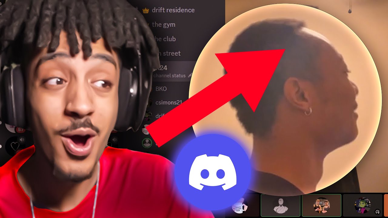 His Hairline Is COOKED! (HAIRLINE REVEAL) *GONE WRONG*