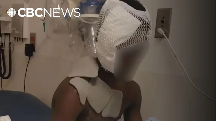 Judge grants bail to Quebec woman accused of throwing boiling water on 10-year-old boy