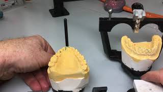 Occlusion: Case Study 1