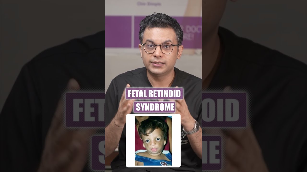 Is Retinoid Safe In Pregnancy?
