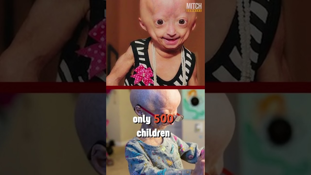 She won over the hearts of millions. #inspiring #reels #youtuber #adalia