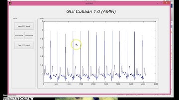 Matlab GUI - image processing (ECG)
