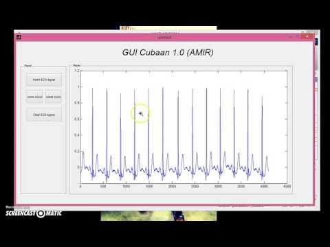 Matlab GUI - image processing (ECG)