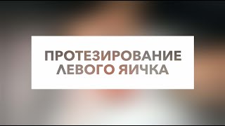 Протезирование яичка (видео операции)